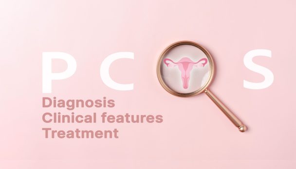 PCOS feature image2(V3)