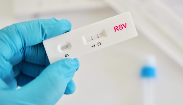 Rsv,Positive,Test,Result,By,Using,Respiratory,Syncytial,Virus,(rsv)