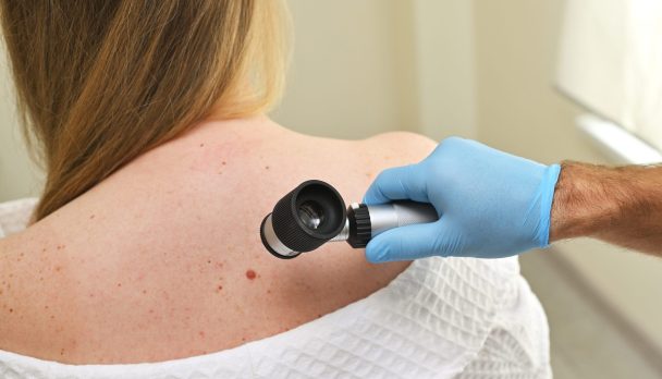 A,Dermatologist,Oncologist,Uses,A,Dermatoscope,To,Examine,Moles,And