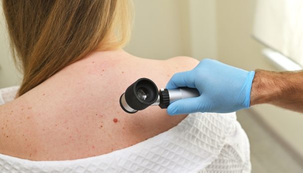 A,Dermatologist,Oncologist,Uses,A,Dermatoscope,To,Examine,Moles,And